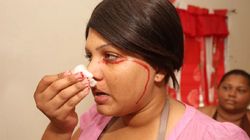 Płakała krwią. Cierpi na rzadkie schorzenie