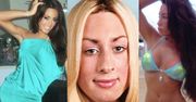 Ofiara operacji plastycznych wydala prawie 800 tysięcy złotych na swoje "wymarzone ciało"!