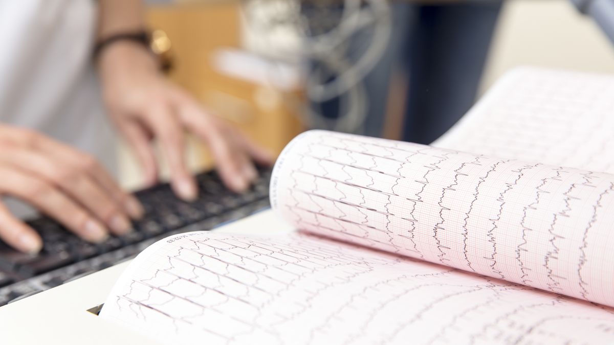 AI pomoże diagnozować arytmię