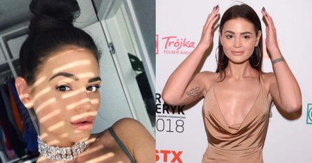 Honorata Skarbek komentuje operacje plastyczne: "Gdy widzę zdjęcia Kylie Jenner, to WYDAJE MI SIĘ, ŻE TO JA. Mamy PODOBNE RYSY TWARZY"