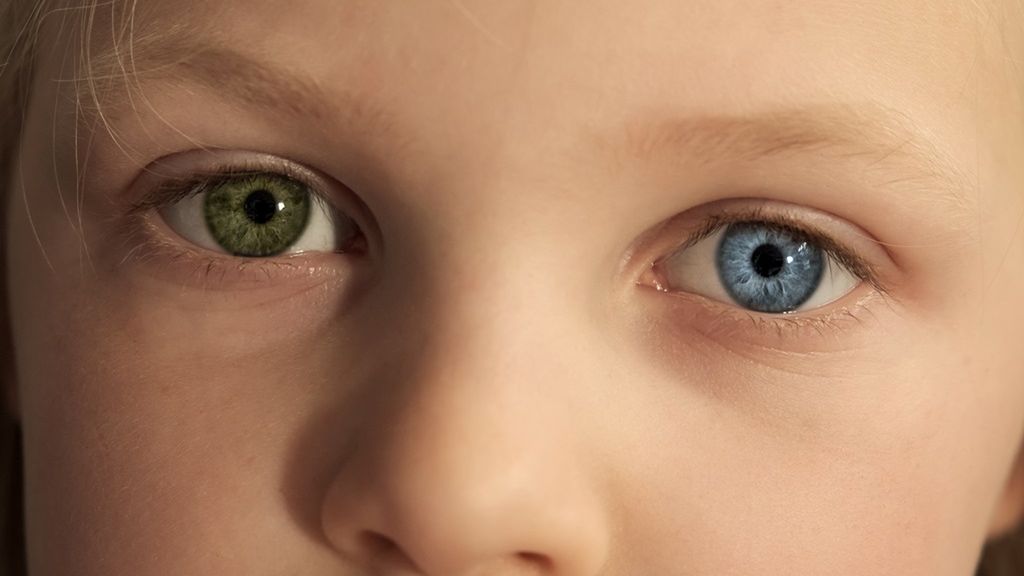 Heterochromia to niegroźna wada genetyczna, w wyniku której oczy jednego człowieka mogą mieć różną barwę