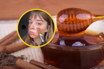 Wypróbowała hitową maseczkę na trądzik. Skóra wygląda o niebo lepiej