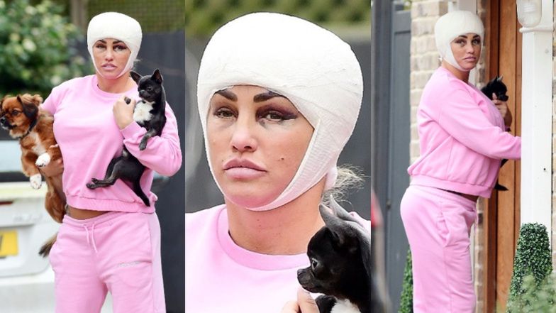 Posiniaczona Katie Price W BANDAŻACH wraca do domu po kolejnej operacji plastycznej (ZDJĘCIA)