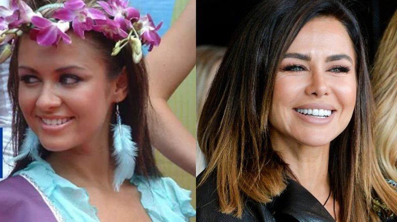 Najdroższe uśmiechy gwiazd