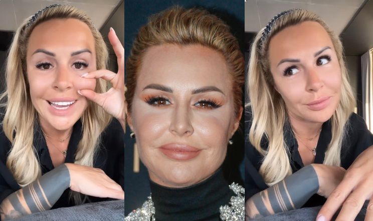 Blanka Lipińska cierpliwie wylicza, "CO MA W TWARZY ZROBIONEGO"