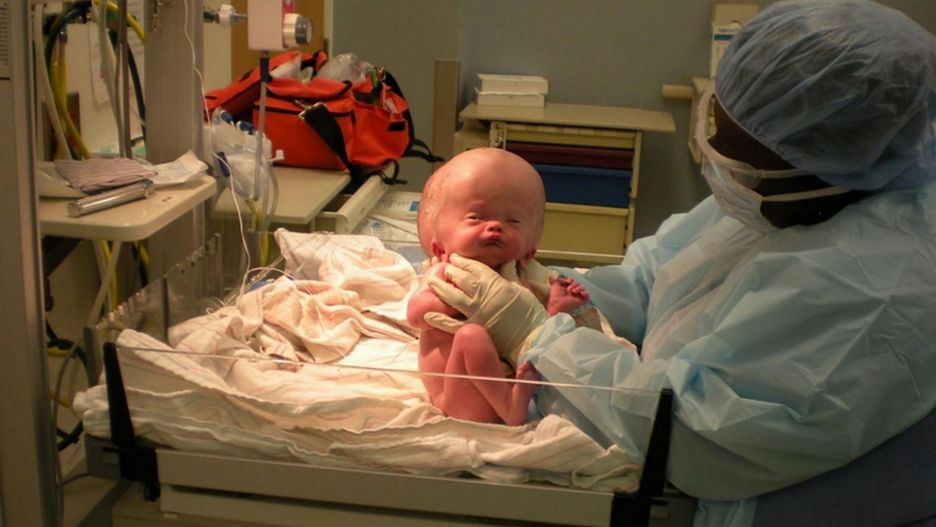 Lekarze nie dawali mu szans. Tak wygląda 15 lat później