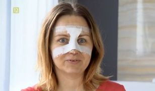 Kasia Klich pokazała nowy nos. Efekt warty był cierpienia?