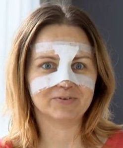 Kasia Klich pokazała nowy nos. Efekt warty był cierpienia?