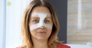 Kasia Klich pokazała nowy nos. Efekt warty był cierpienia?
