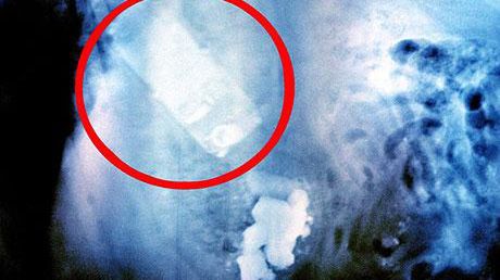 Pies, który połknął telefon 1