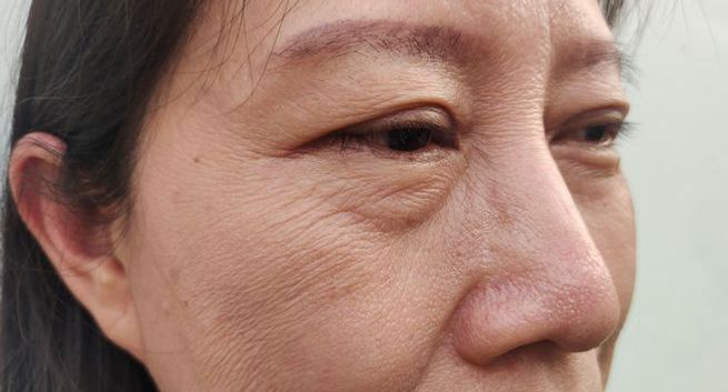 Zmarszczki na twarzy zdradzają, jak długo jeszcze będziemy żyli