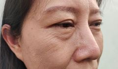 Zmarszczki na twarzy zdradzają, jak długo jeszcze będziemy żyli