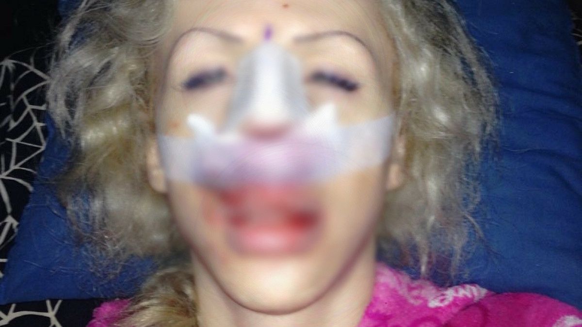 Juliette Stray wydała na operacje plastyczne ponad 400 tys. zł 