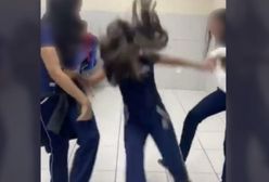 Nastolatka złamała kręgosłup odtwarzając trend z TikToka