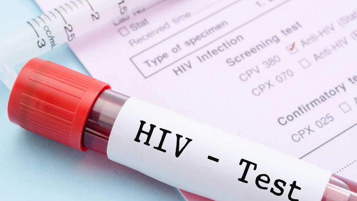 HIV rozprzestrzenia się w Rosji. Ponad milion nosicieli wirusa