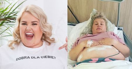 Kinga Zawodnik o ciemnych stronach operacji zmniejszenia żołądka: "Myślałam, że TEN PROBLEM mnie nie dotknie..."