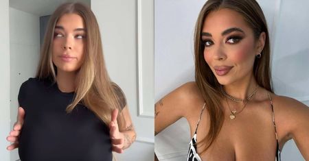 Kori z "Hotelu Paradise" ZMNIEJSZYŁA BIUST. Pokazała efekt "przed i po"