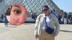 Objaw był widoczny. Lekarze zignorowali, a to był znak raka