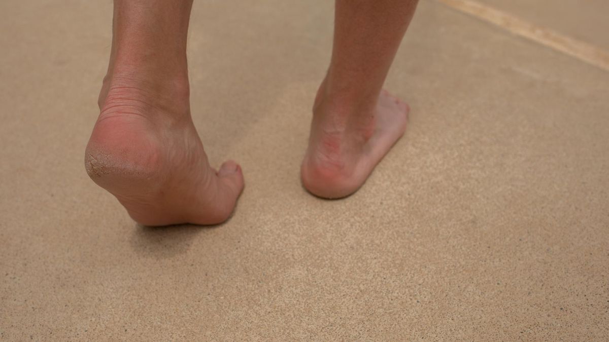 Jeden objaw demencji zauważysz podczas chodzenia