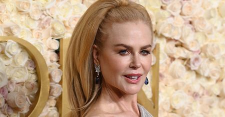 Fani są zaniepokojeni. Widzą u Nicole Kidman "uszy nietoperza"