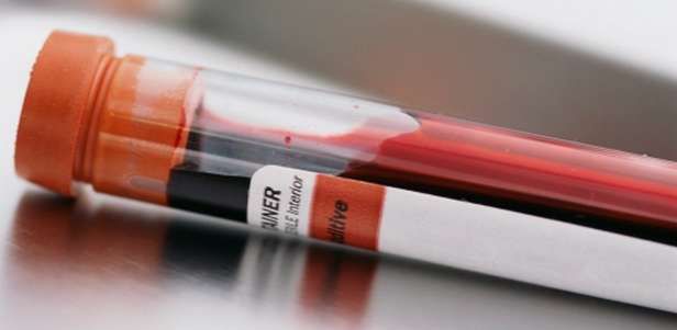 Liczba markerów we krwi pozwoli określić prawdopodobieństwo depresji (Fot. Find My Health)