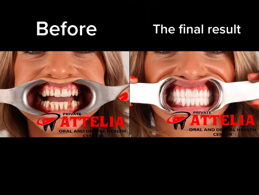Turecka metamorfoza z piekła rodem