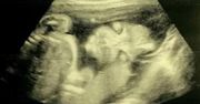 Niesamowite zdjęcia USG. Nawet lekarze byli zaskoczeni