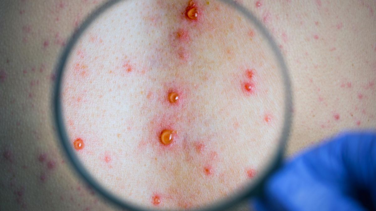 USR - charakterystyka, wskazania do badania, opis badania, interpretacja wyników