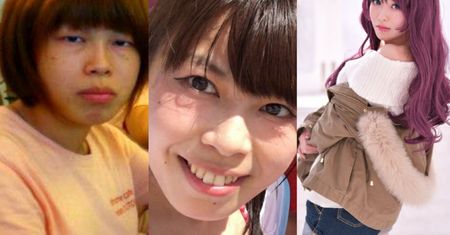 Japonka przeszła totalną metamorfozę dzięki operacjom plastycznym! Tak wyglądała kiedyś... (ZDJĘCIA)