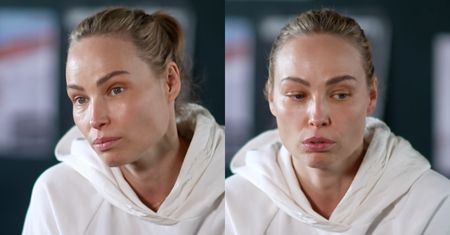 Weronika Książkiewicz o chorobie, która odebrała jej sprawność na lata. "Żyłam z ciągłym bólem"