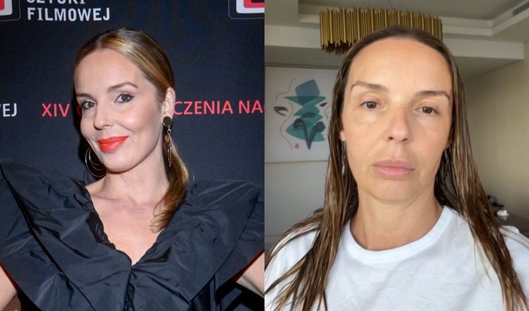 Agnieszka Włodarczyk szczerze o zabiegach kosmetycznych