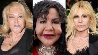Te gwiazdy ZMASAKROWAŁY sobie twarz operacjami plastycznymi: Donatella Versace, Linda Evangelista, Jocelyn Wildenstein i inni