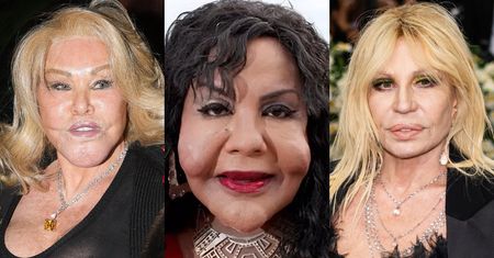 Te gwiazdy ZMASAKROWAŁY sobie twarz operacjami plastycznymi: Donatella Versace, Linda Evangelista, Jocelyn Wildenstein i inni
