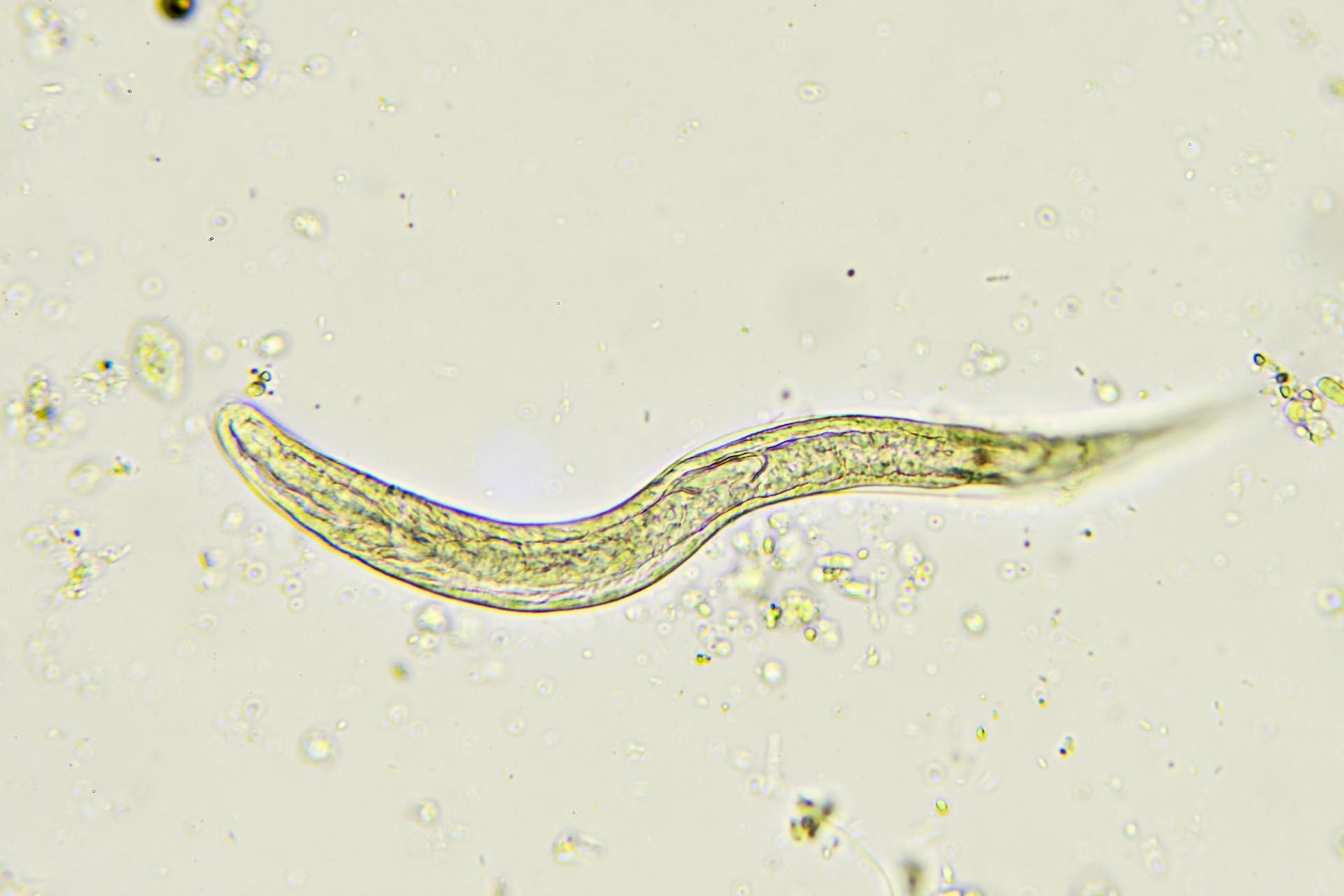 Jednym z podstawowych objawów owsików jest świąd