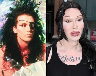 Nie żyje Pete Burns z Dead or Alive! Miał 57 lat...