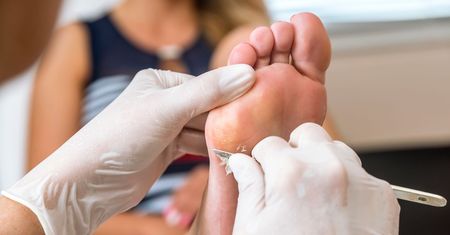 Te buty powodują haluksy. Podolożka ostrzega