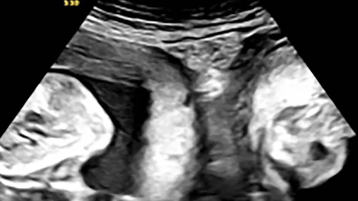 Prawdziwy cud narodzin.