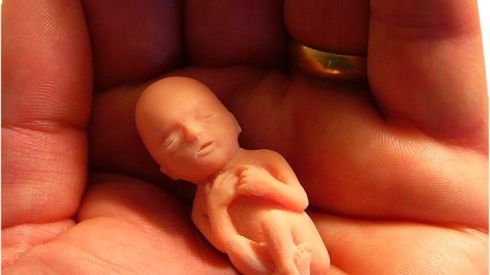 W ciąży z trupem 1