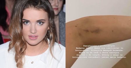 POSINIACZONA Maffashion prawi o walce z niedoczynnością tarczycy: "OPUCHLIZNA BYŁA NAWET NA POWIEKACH"