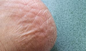 Wsmaruj w stopy i załóż skarpetki. Rano będą gładkie jak u niemowlaka