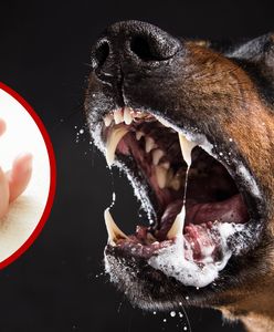 Groźne psy zaatakowały malutkie dziecko w Australii. Pięciotygodniowa dziewczynka nie żyje