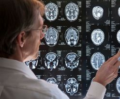 Badanie mózgu pozwoli badaczom na znalezienie przyczyn wielu chorób