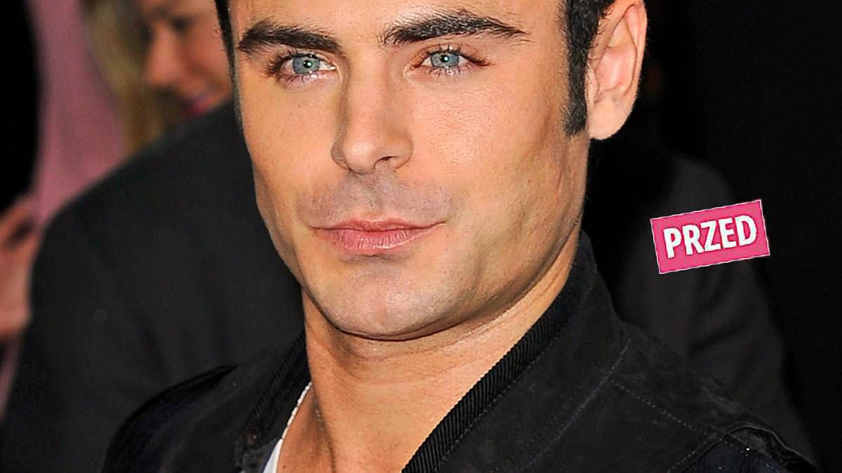 Zac Efron ma nową twarz! Oj, chyba przesadził z poprawianiem urody