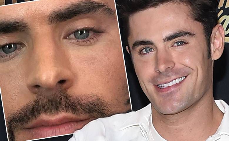 Przystojny Zac Efron oszpecił się. Co się stało z jego śliczną buźką?