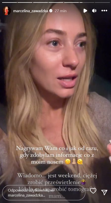 Marcelina Zawadzka miała wypadek. Co się stało? (fot. InstaStories)