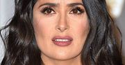 Salma Hayek miała bardzo przykry wypadek. Pokazała zdjęcie. Nadal odczuwa ból