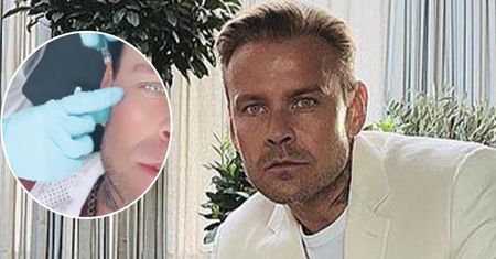 Dawid Woliński nagrał, jak wprowadzają mu pod skórę nici. Auć! Boli od samego patrzenia