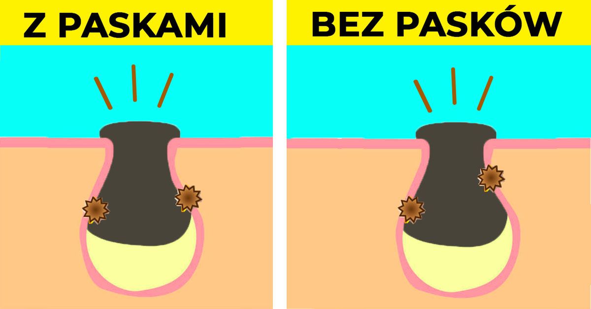 Obrazek