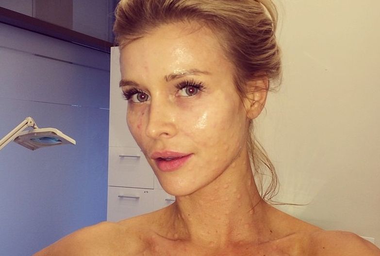 Joanna Krupa zrobiła sobie lifting? Mamy komentarz!  [wideo]