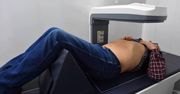 Ponad 90 proc. osób z osteoporozą nie jest leczonych